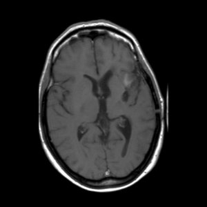 M.R.I. scan, 8 januari 2010